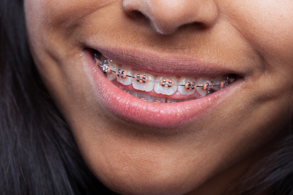 about our orthodontic office 